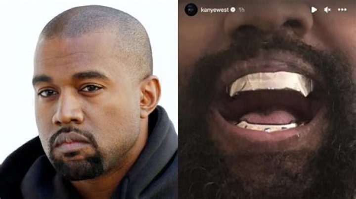 Did Kanye West Really Die? The Shocking Truth