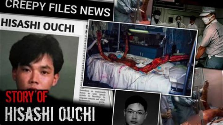 Hisashi Ouchi Real Photos 2024: A Deep Dive into the Life and Legacy of a Nuclear Accident Survivor