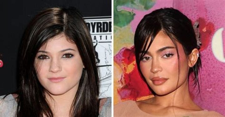 Kylie Jenner's Lips: The Secret Behind Her Iconic Look