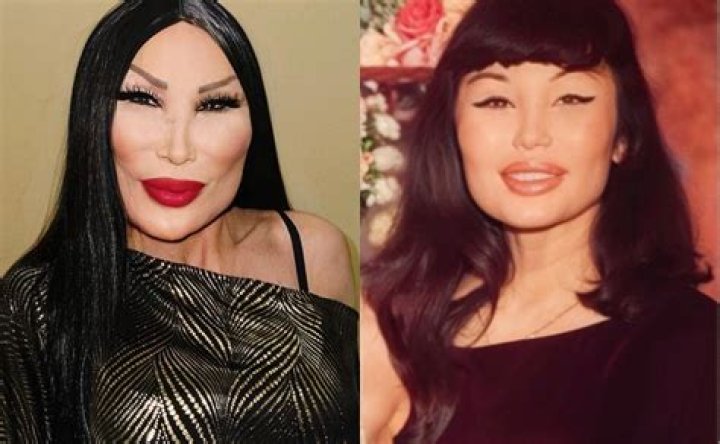 Lyn May Botox: A Comprehensive Look at the Iconic Celebrity's Journey with Aesthetic Enhancements