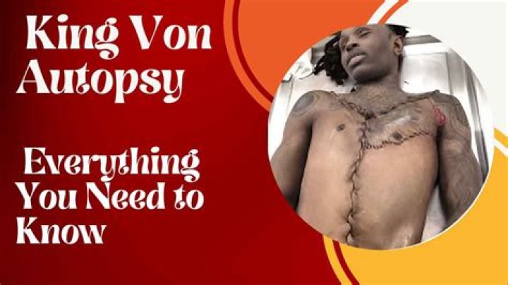 Understanding King Von's Autopsy: A Deep Dive into His Life and Legacy